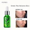 ROREC Green Tea Face Serum Anti-Wrinkle Anti-Aging Collagen Moisturizing Esence 15ml - Image 4