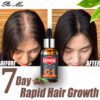 CAFFENINE Anti-Hair Loss Essential Oil Hair Care 30ml