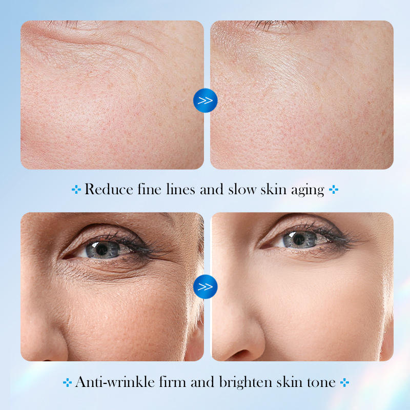 SADOER 8D Hyaluronic Acid Freeze-Dried Powder Set Imported - Image 4
